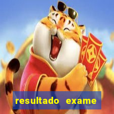 resultado exame eliel figueiredo